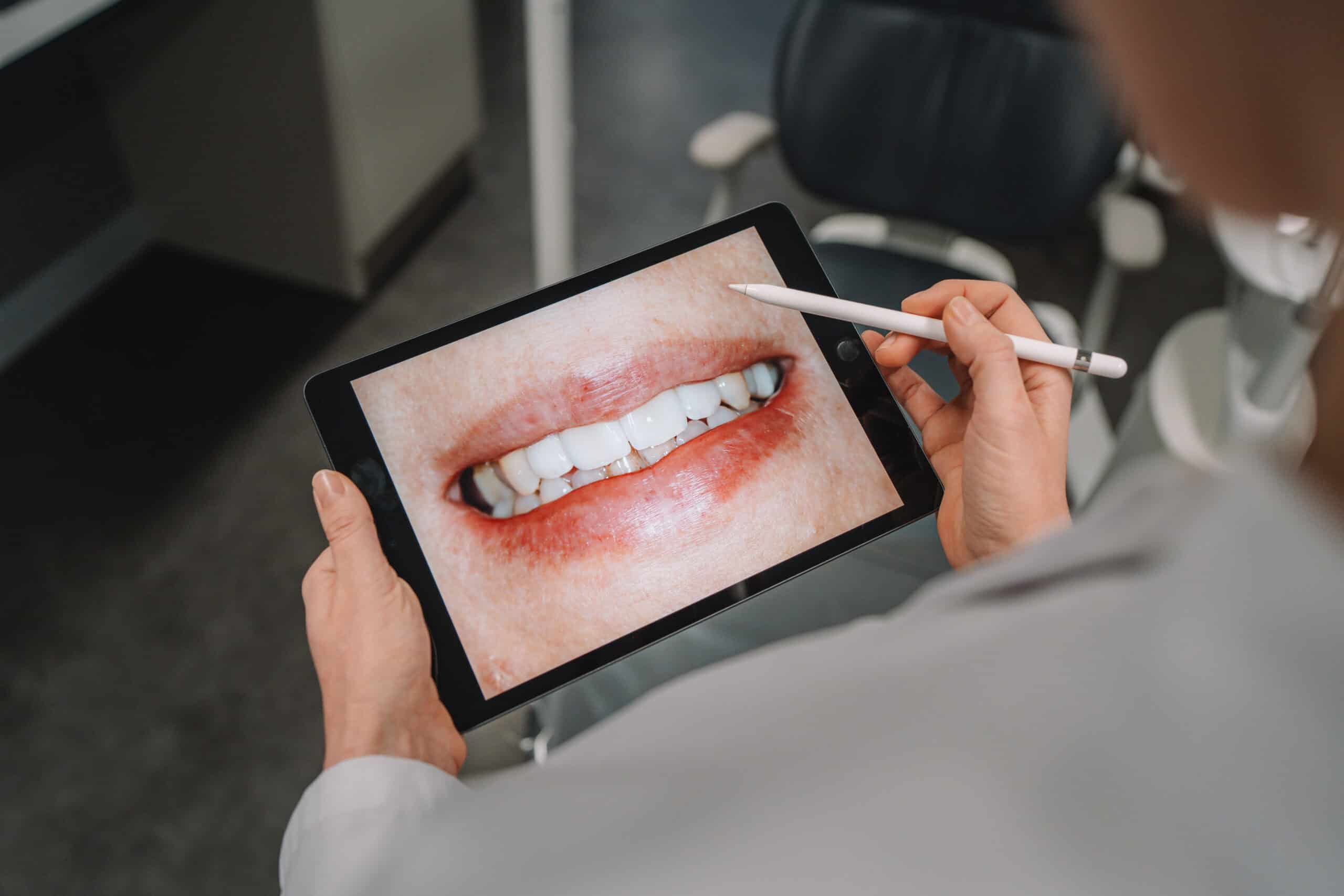 Kittler Dent – Jak to děláme v Kittler Dentu?