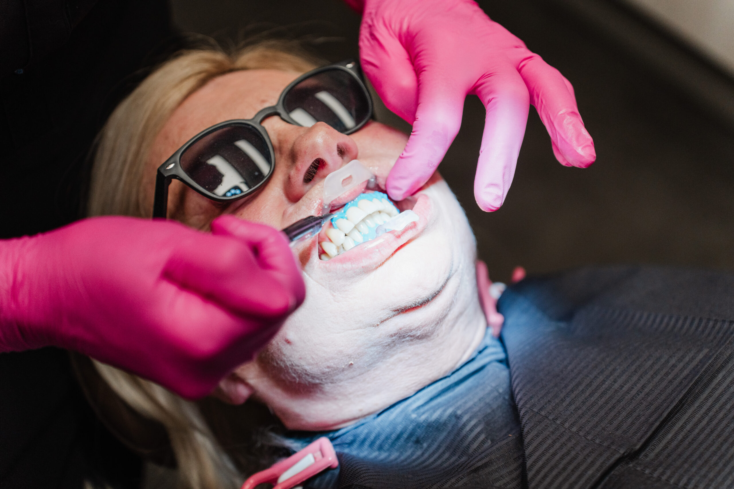 Kittler Dent – Jak u nás probíhá dentální hygiena?