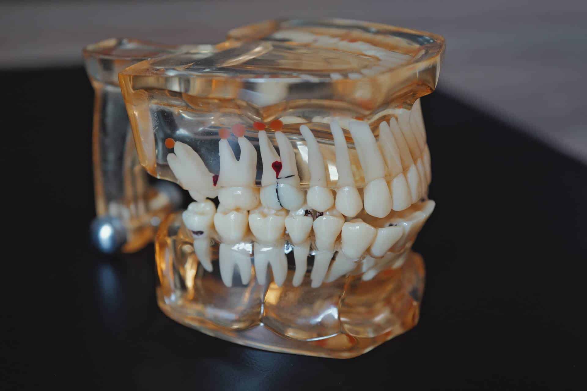 Proč je endodontické ošetření náročné – a proč stojí za svou cenu?