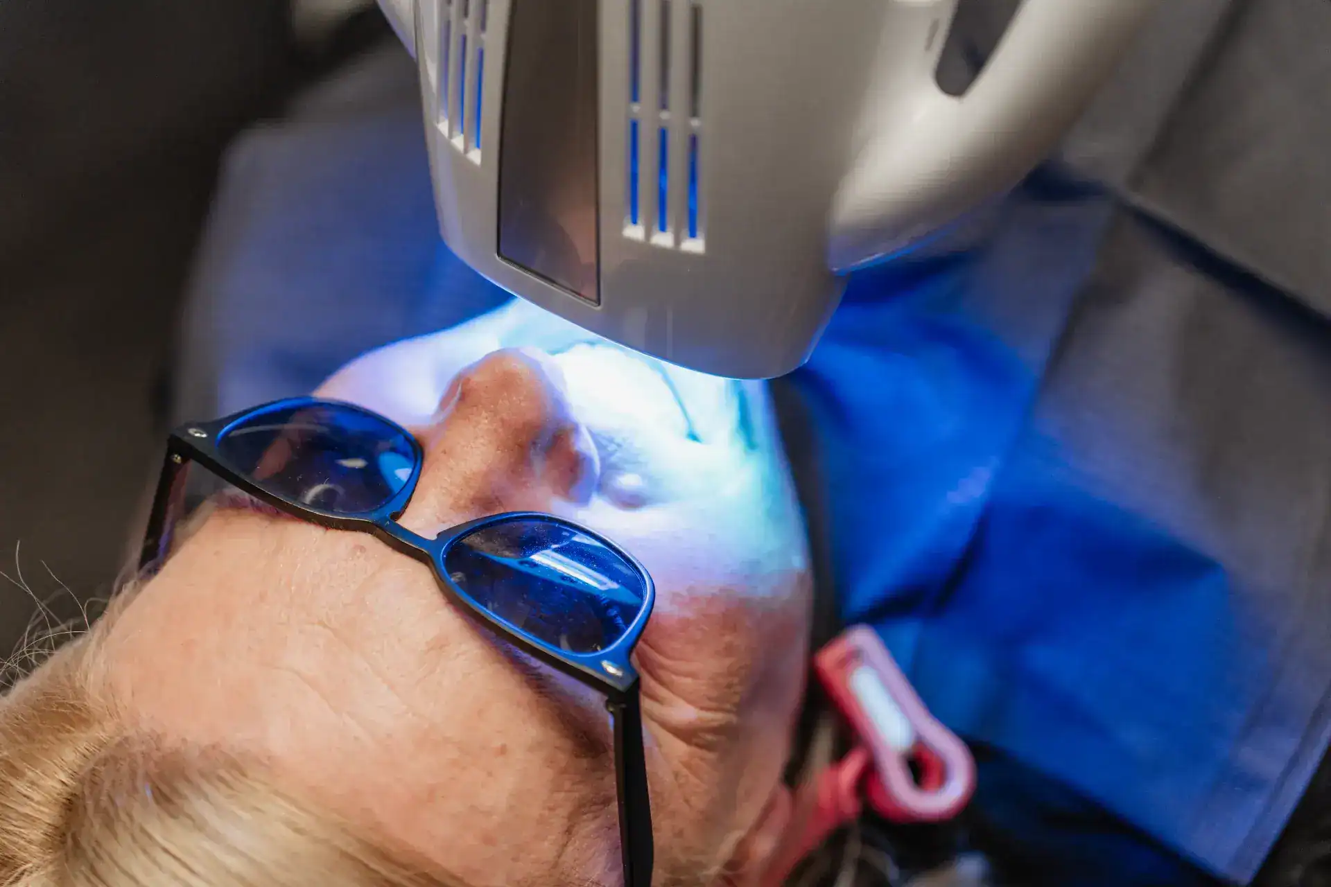 Vše, co potřebujete vědět před bělením zubů: Jak to děláme v Kittler Dentu?